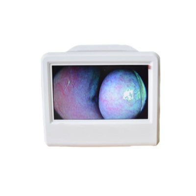 Medical Electronic Image Examiner ENT HD Portable Endoscope Camera